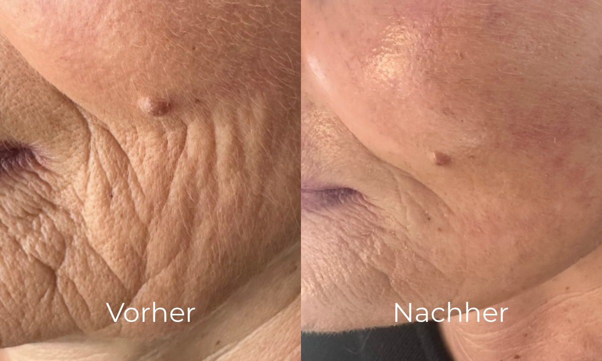 before-after image
