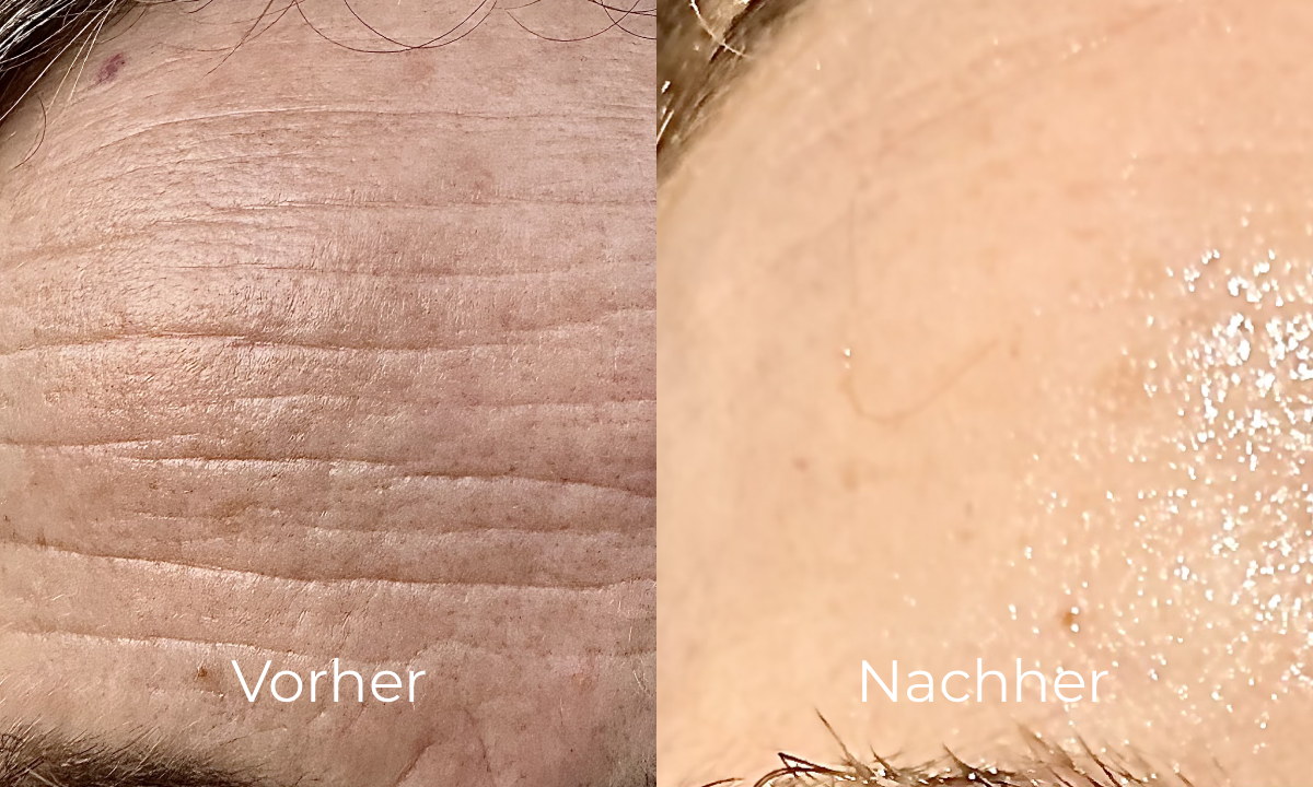 before-after image