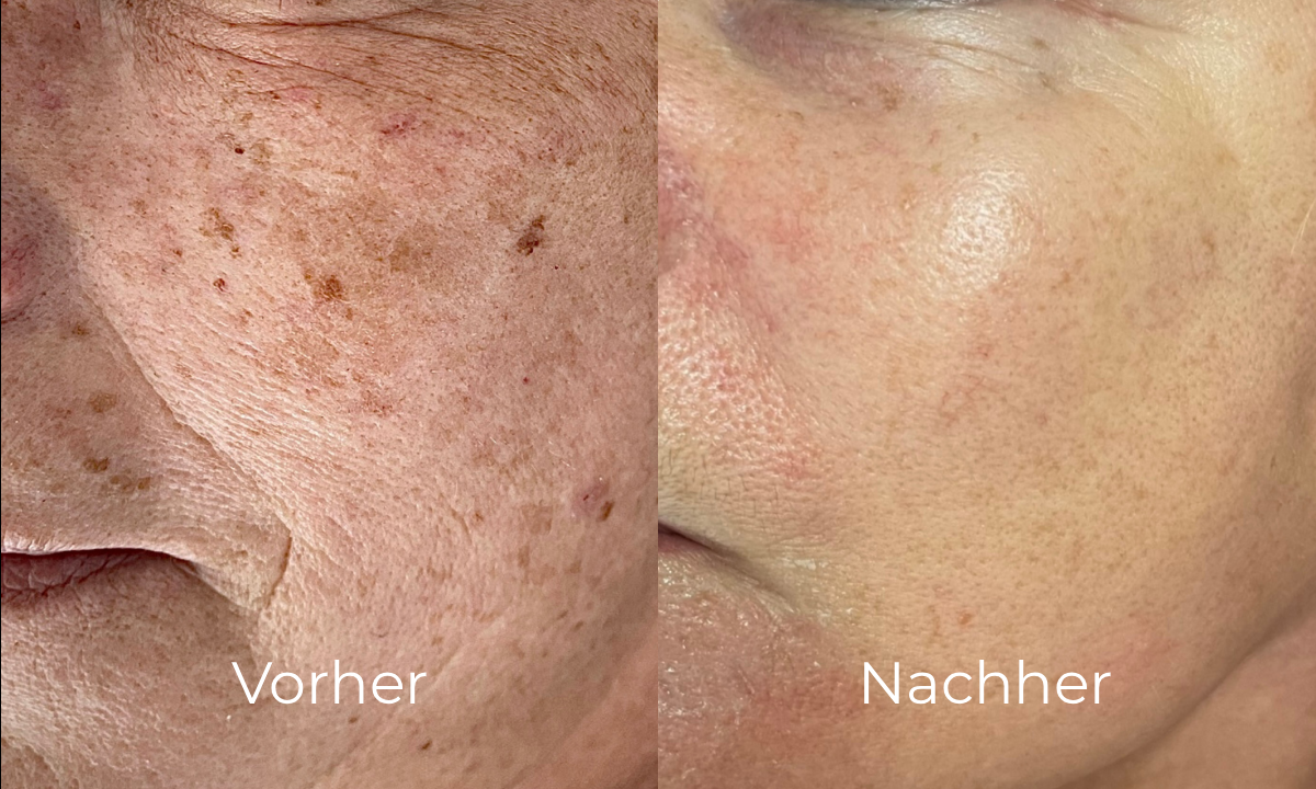 before-after image