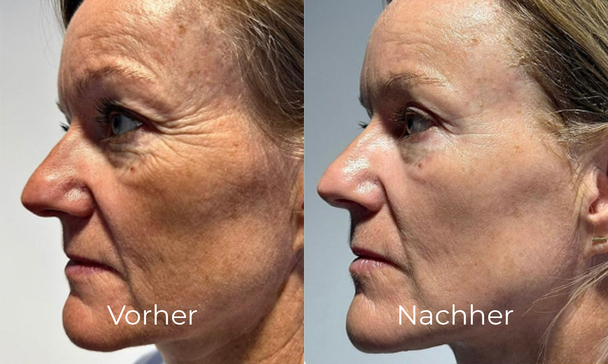 before-after image