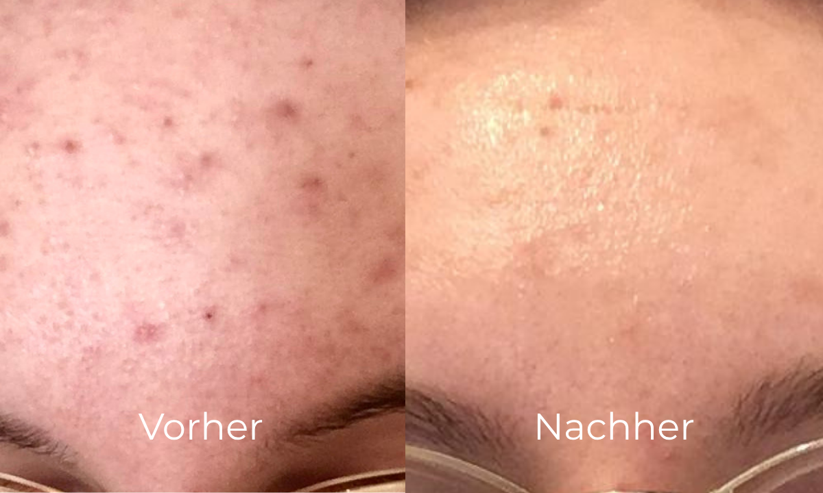 before-after image