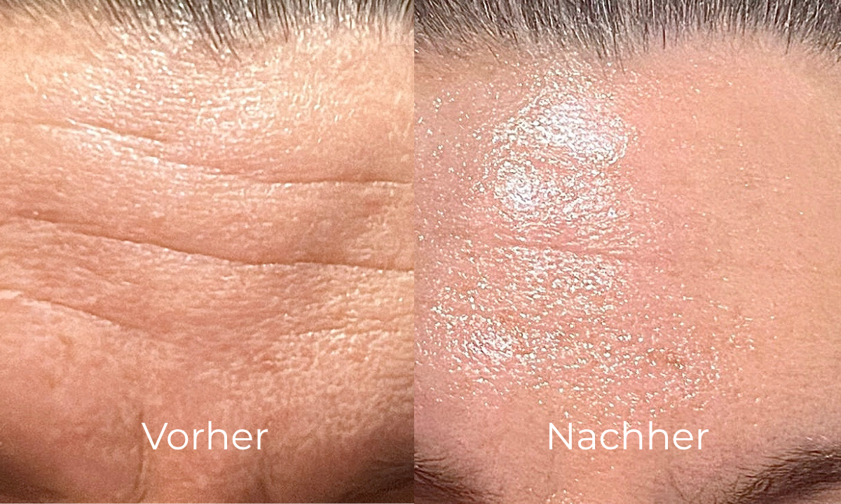 before-after image