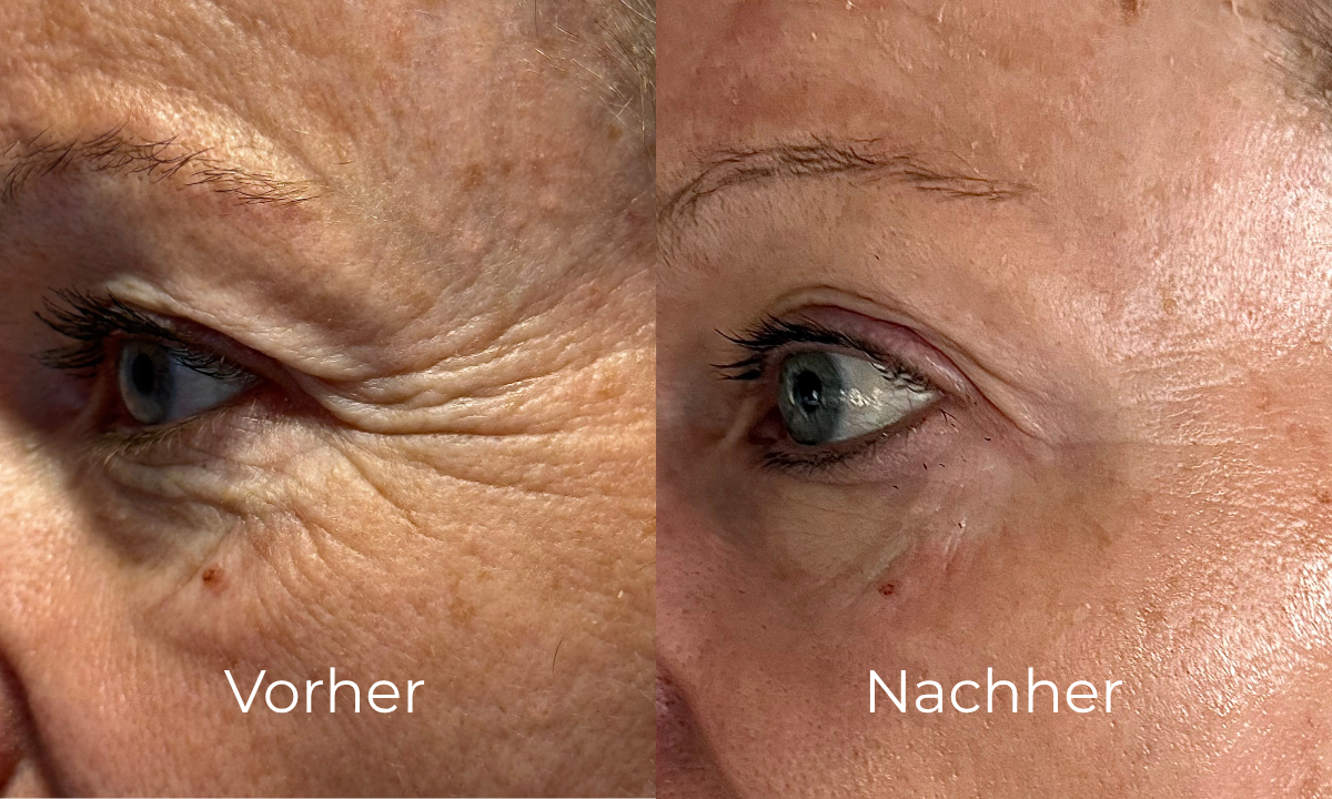 before-after image