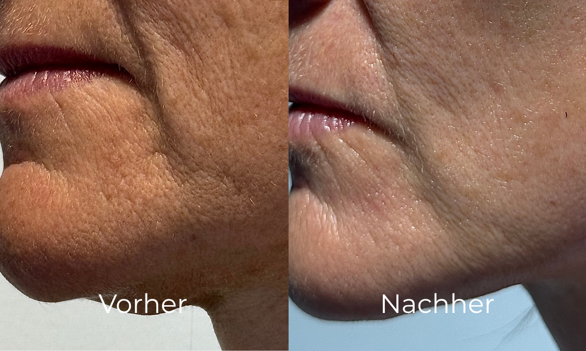 before-after image