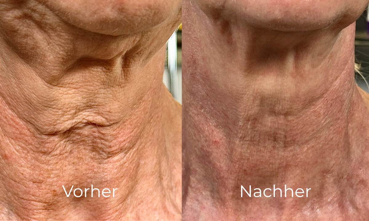 before-after image