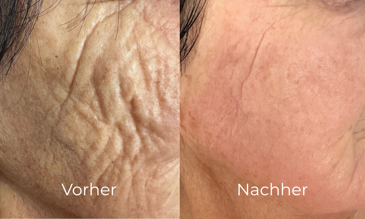 before-after image